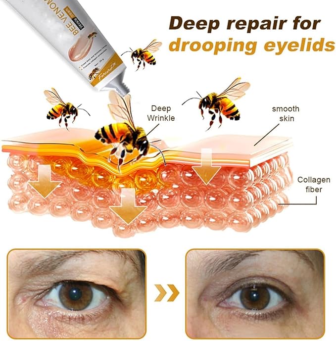 Botox Bee Venom